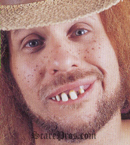 hillbilly_teeth.jpg