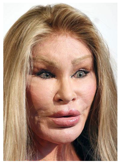 CelebrityPlasticSurgeryGoneWrong.jpg