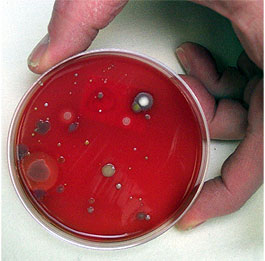 Bacteria-Growth-Agar-TSA.jpg