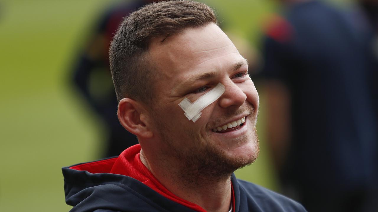 May all smiles, despite a serious battlescar suffered earlier this season.. Picture: AFL Photos/Getty Images