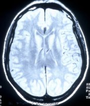 getty_h_110210_brainscan.jpg