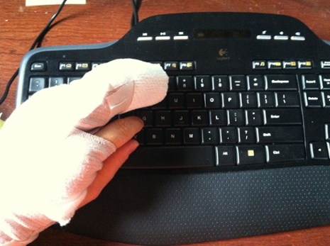 jimmy-hovey-blogging-tips-broken-finger-on-a-keyboard.jpg
