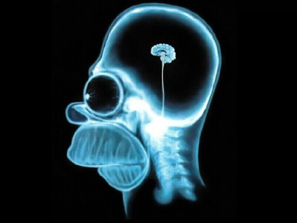 homer_brain_scan.jpg