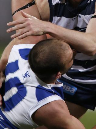 Ben Cunnington has battled with his hairline for a number of seasons.