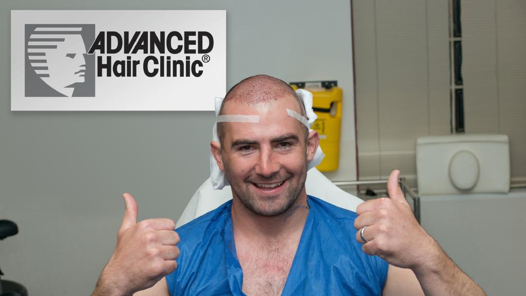 Ben Cunnington is having a hair transplantation at Advanced Hair. Picture: Supplied