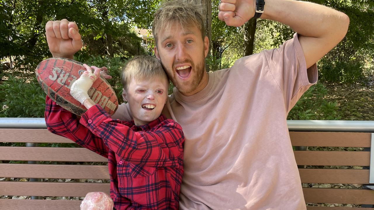 Warranwood's Harrison Pennicott, 9, and Essendon captain Dyson Heppell celebrate Harrison's good health news at Ringwood North's McAlpin Reserve. Picture: Kiel Egging.