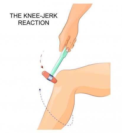 depositphotos_143914309-stock-illustration-the-knee-jerk-reflex.jpg