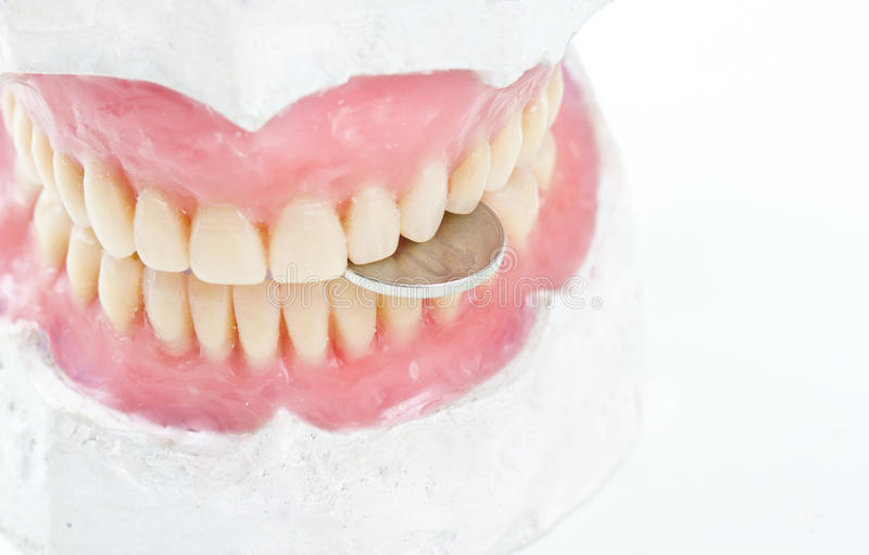 wax-prosthesis-biting-coin-dental-gypsum-model-31845873.jpg